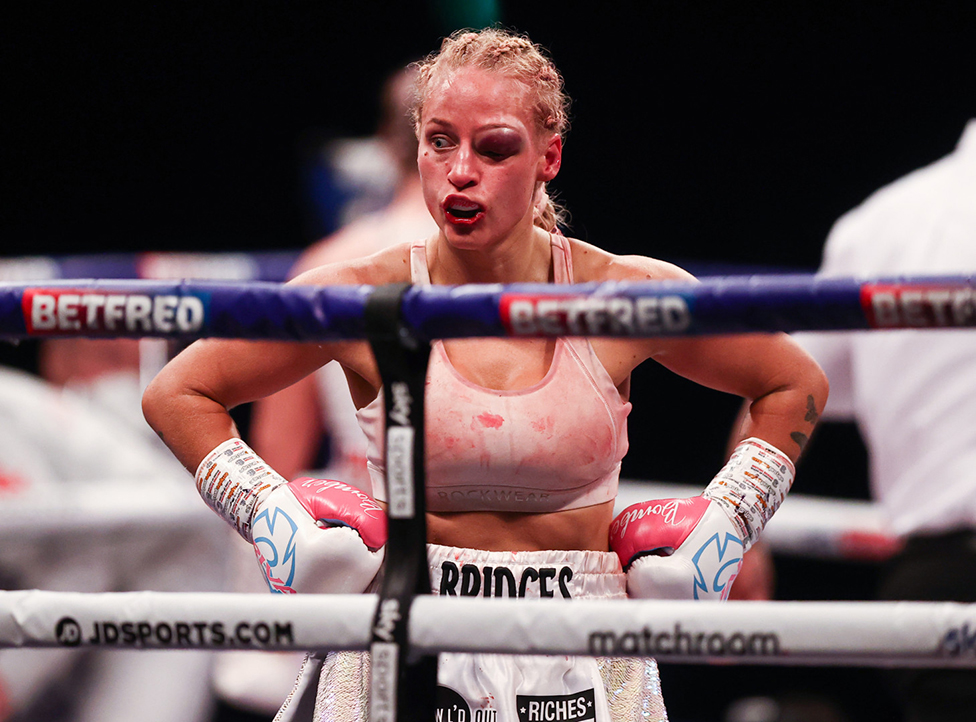 Ebani Bridžis iz Australije zadobila je nezgodnu povredu oka tokom borbe za titulu u kateforiji bantam za žene, boksujući u Londonu u aprilu 2021. godine protiv domaće takmičarke Šenon Kortini
